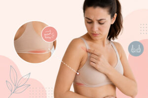 Can tight bras cause comfort or skin irritation